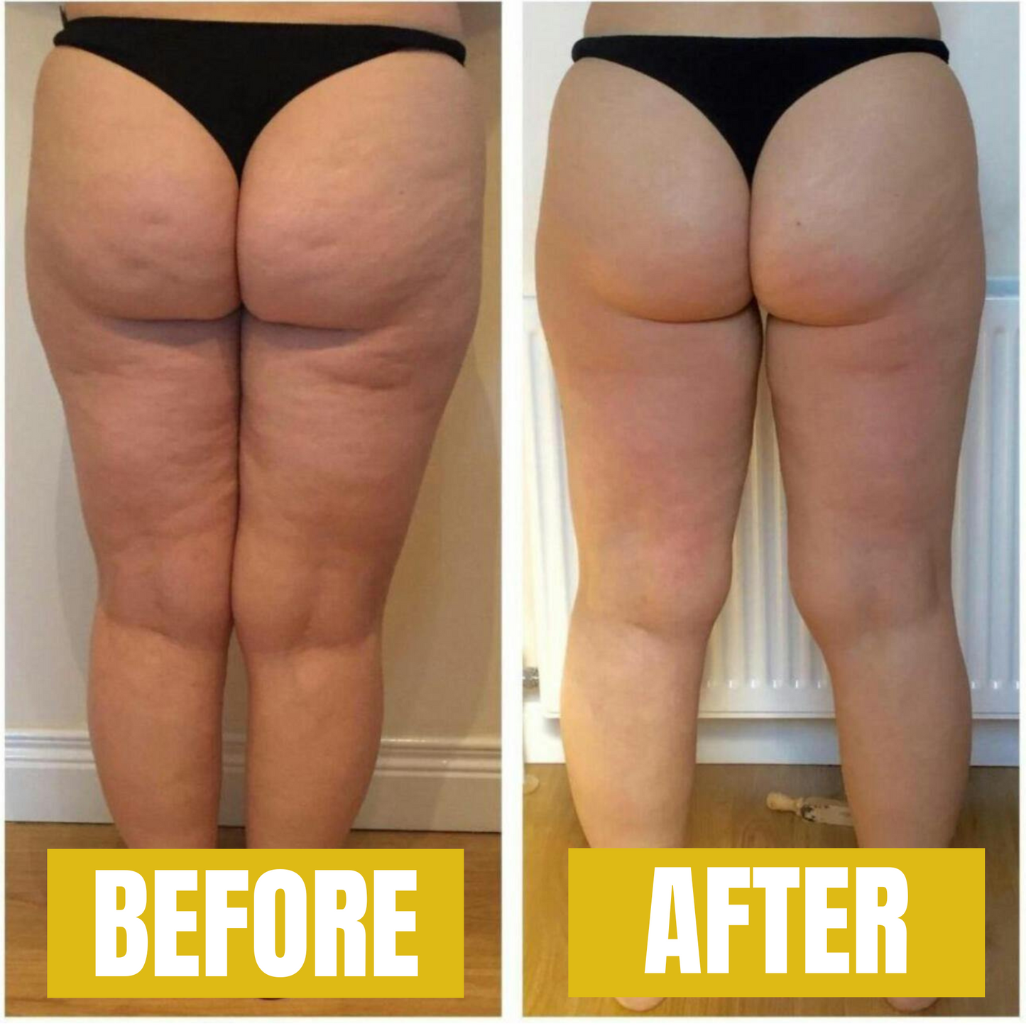 Celurex Anti-Cellulite Massage Oil