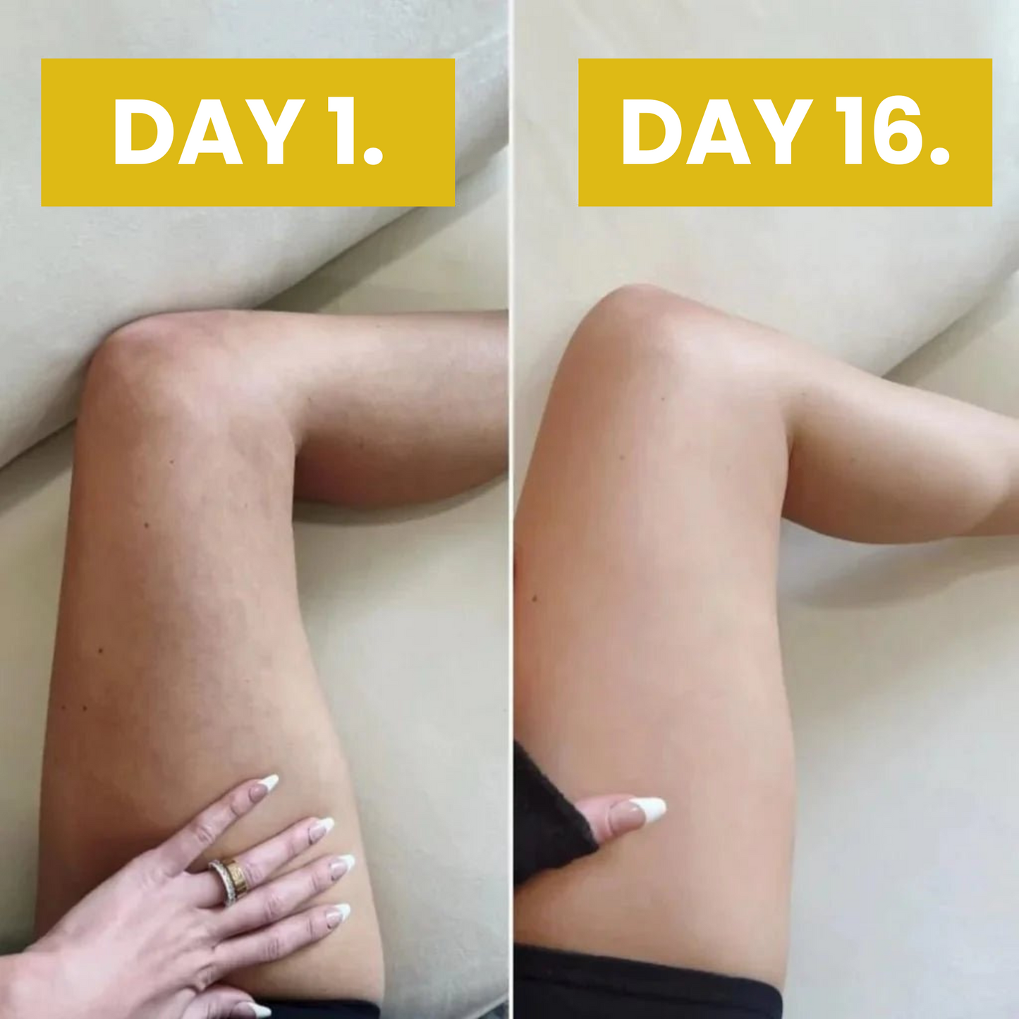 Celurex Anti-Cellulite Massage Oil