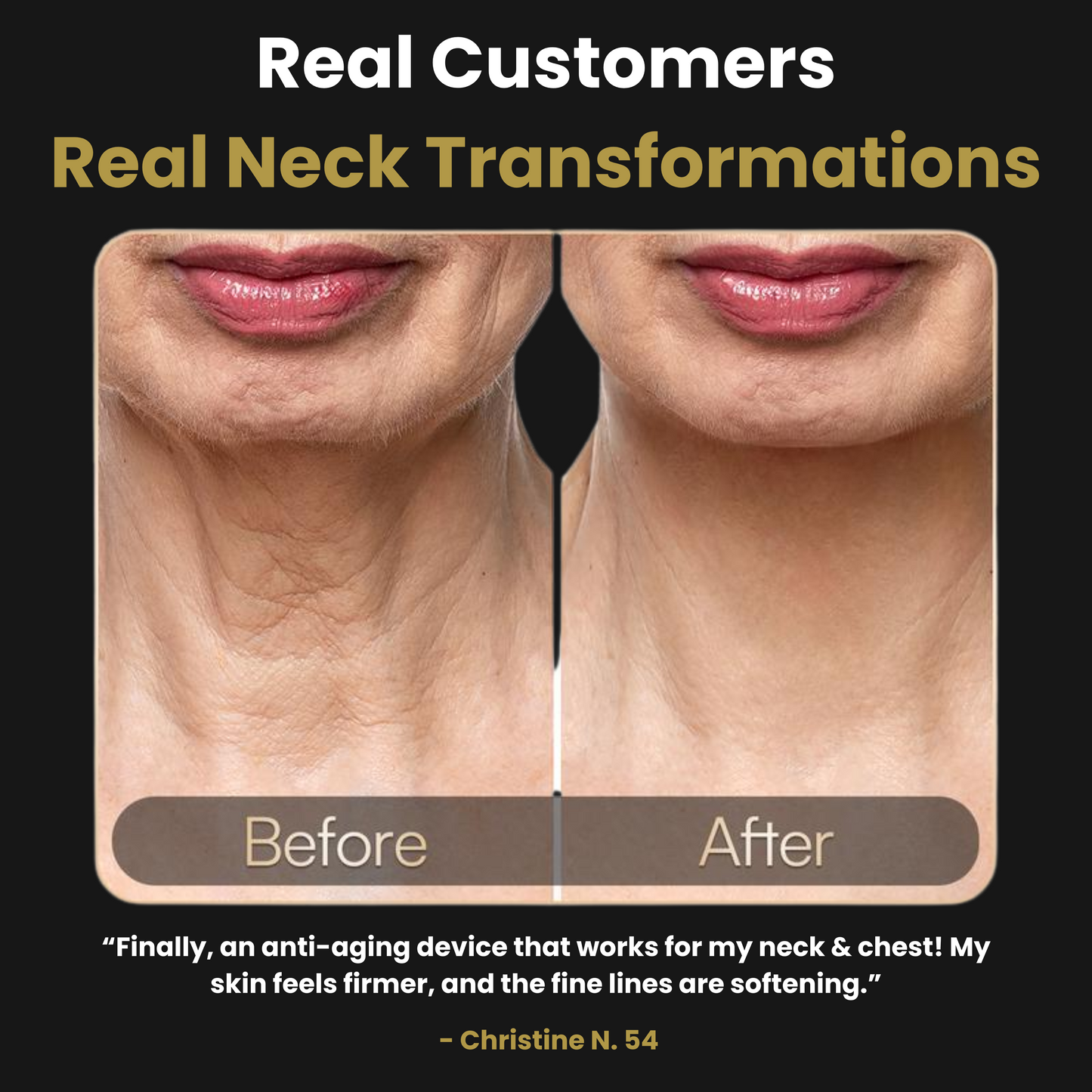 Lani Neck & Chest Red Light Mask